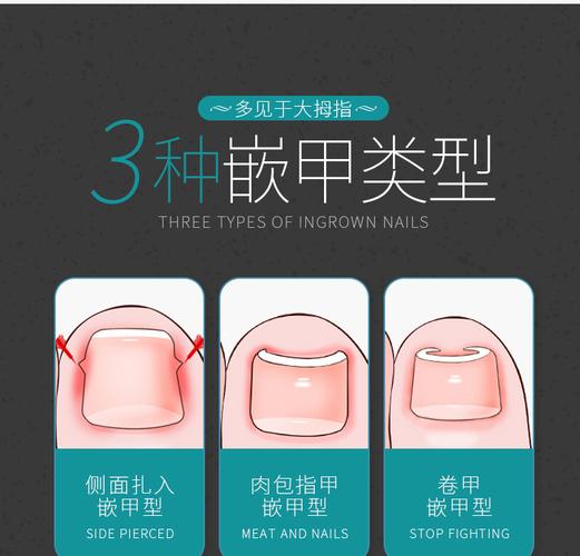 厂家直销修脚服务 源头价格，现货首选